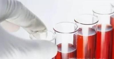 如何判断孩子的血型 根据父母血型推断孩子血型