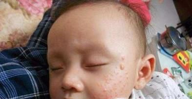 沙棘膏的功效与作用