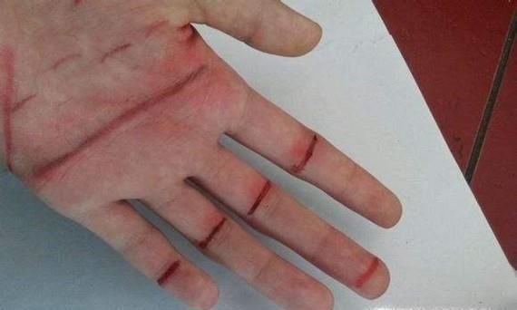 沙棘膏的功效与作用