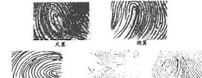 手指上的斗和簸箕决定一个人的健康？