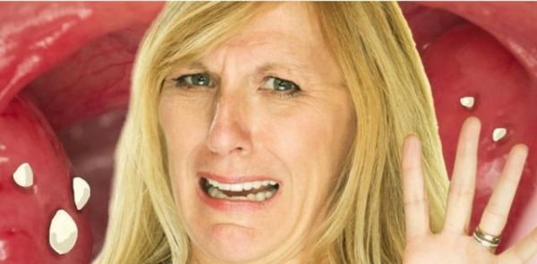 口苦口干口臭怎么办？是哪些原因造成的？