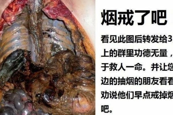 戒烟的最好办法是什么？