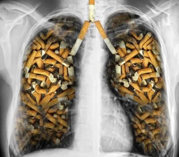 戒烟的最好办法是什么？