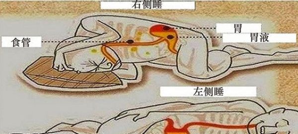 怎样的睡姿最健康？