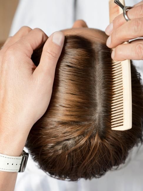 我的头发两天不洗就油得不行，是不是身体有问题啊？