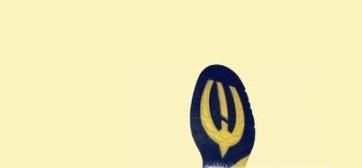 冬天下雪后防止滑倒的方法有哪些?