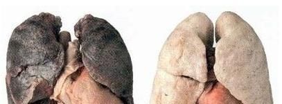 戒烟后,肺部还能恢复正常吗,需要多久?