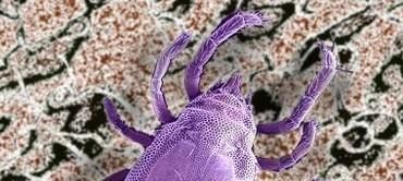 生活去螨小妙招