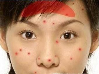 不经常洗头的危害有哪些