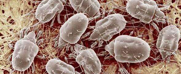 身上螨虫多了，身体会出现哪些信号？