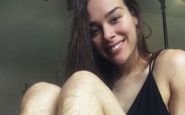 女性体毛过多什么原因?