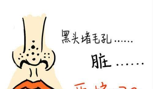 脸上黑头除不掉怎么办，鼻贴去黑头有用吗？