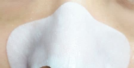 脸上黑头除不掉怎么办，鼻贴去黑头有用吗？