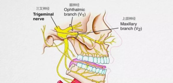 看见阳光就想打喷嚏？