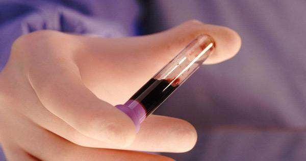 什么血型最稀有?