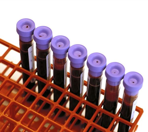 什么血型最稀有?