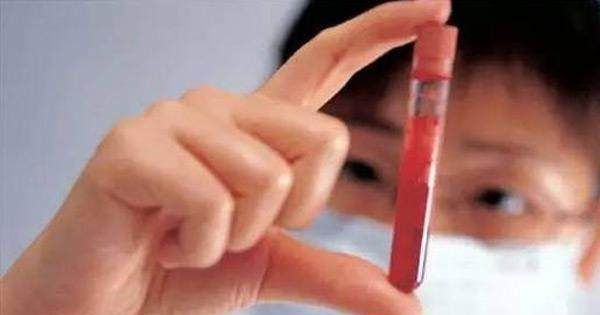 什么血型最稀有?