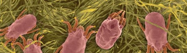 怎么判断床上有螨虫?