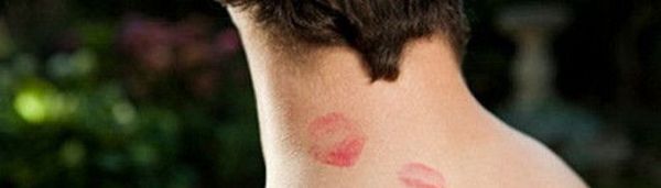 草莓印怎么快速消除?