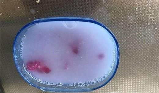 透明手机壳发黄的解决方法