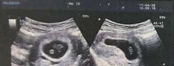 算生男生女的民间方法