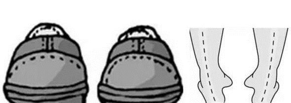 鞋底的磨损程度能够反映哪些状况