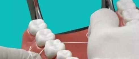 牙线怎么正确使用 有没有坏处 什么牌子牙线好