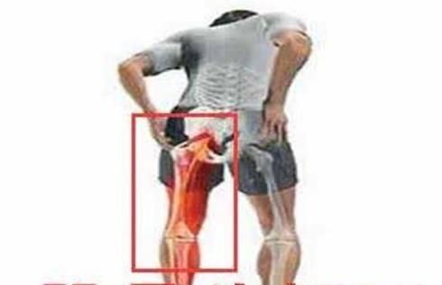 股骨头在人体的哪个位置及作用