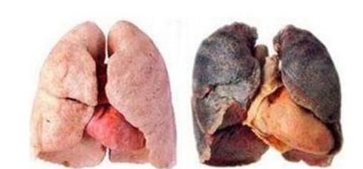 经常抽烟的危害有哪些？