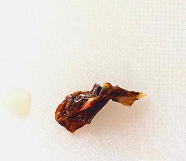 怎样处理虾的详解方法