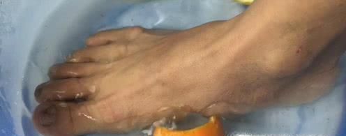 一些水果皮的妙用之处