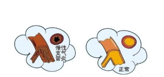 一些水果皮的妙用之处