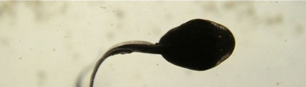 小蝌蚪的尾巴为什么会消失？