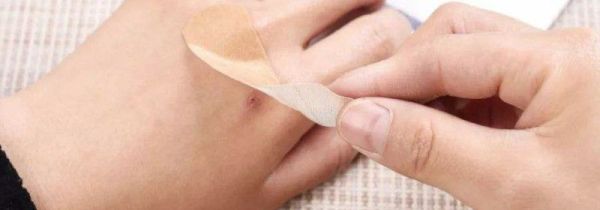 游泳伤口防水小妙招