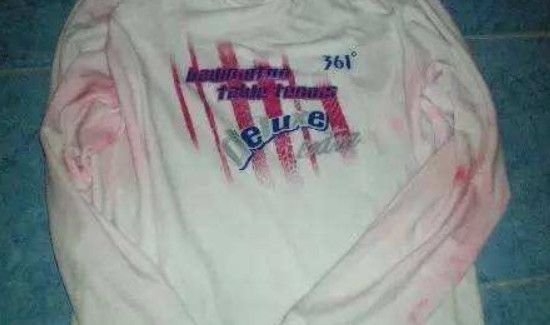 漂白液衣服变红色为什么