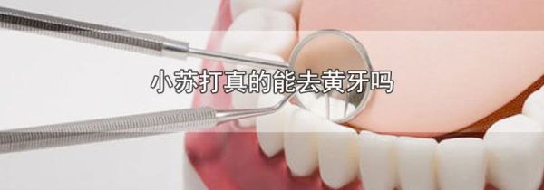 小苏打真的能去黄牙吗