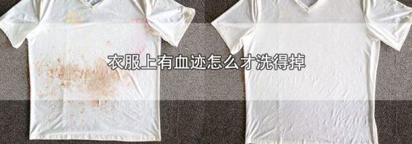 衣服上有血迹怎么才洗得掉