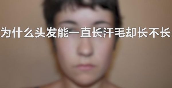 为什么头发能一直长汗毛却长不长