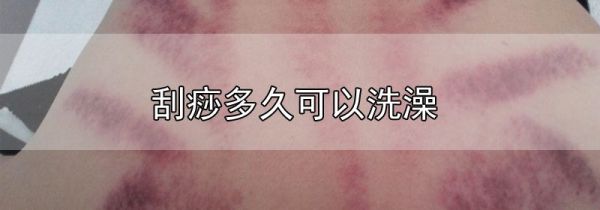 刮痧多久可以洗澡