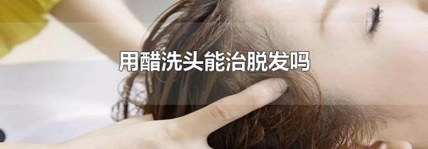 用醋洗头能治脱发吗