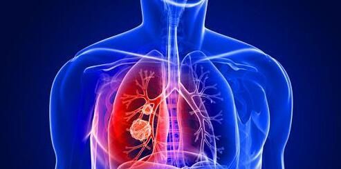 白露节气后，是3种慢性病爆发期，多吃这些帮你“保平安”