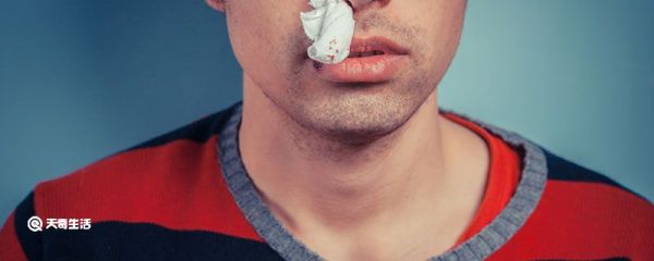 流鼻血怎么处理 流鼻血怎么办