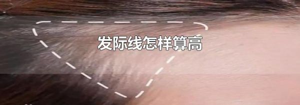 发际线怎样算高