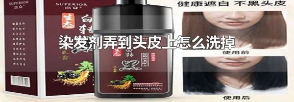 染发剂弄到头皮上怎么洗掉