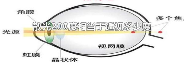 散光200度相当于近视多少度