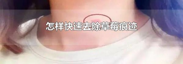 怎样快速去除草莓痕迹