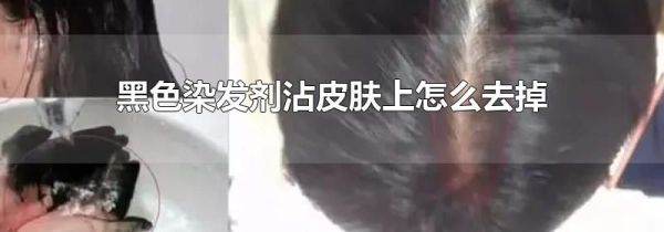 黑色染发剂沾皮肤上怎么去掉