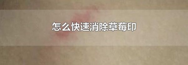 怎么快速消除草莓印