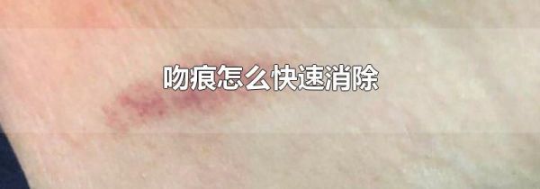 吻痕怎么快速消除