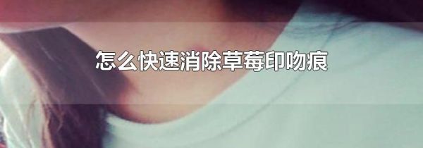 怎么快速消除草莓印吻痕